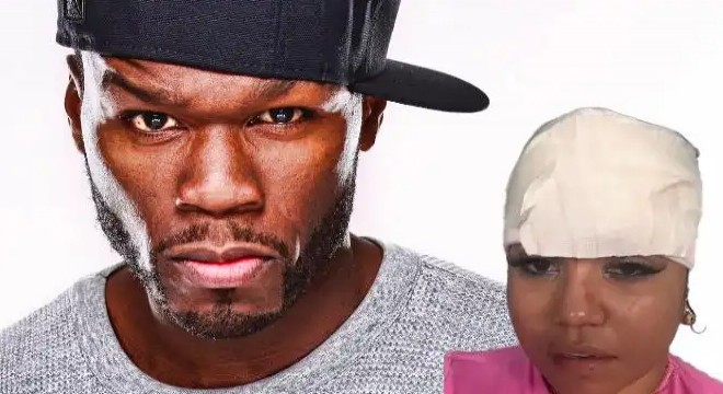 50 Cent kadın hayranının kafasını yardı