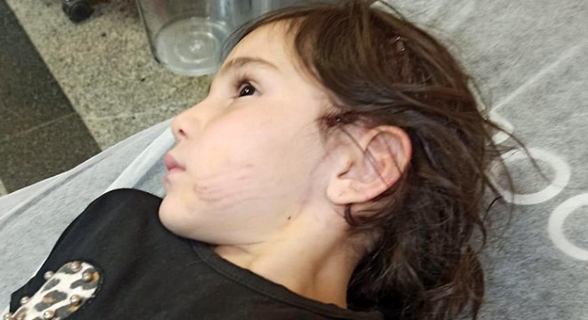 6 yaşındaki Narin, sevdiği köpeğin saldırısında yaralandı