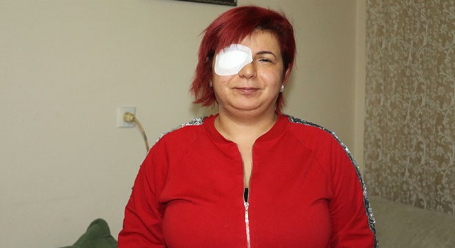 Alerji olan kadının derisi döküldü, sağ gözü görme kaybı yaşadı