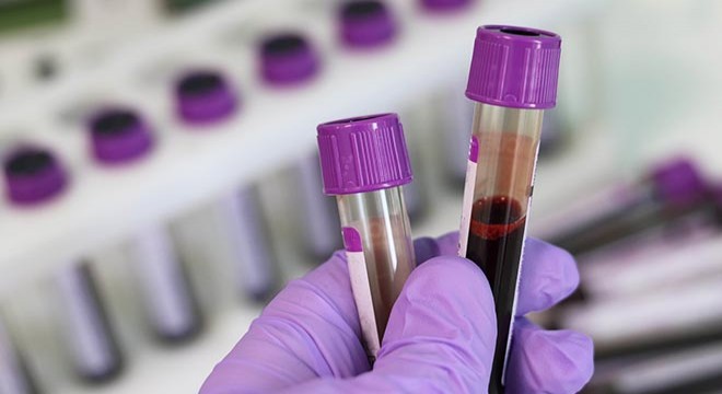 Bilim insanları, 50 kanser türünü doğru tespit eden kan testinin analizini yaptı