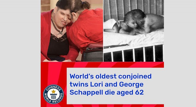 Dünyanın en yaşlı yapışık ikizleri hayatlarını kaybetti