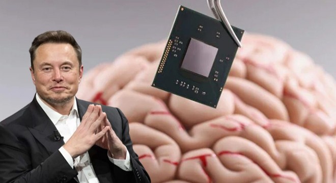Elon Musk ın Neuralink şirketi beyin çipi takmaya hazır
