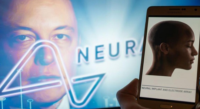 Elon Musk ın şirketi bir insanın beynine çip yerleştirdi