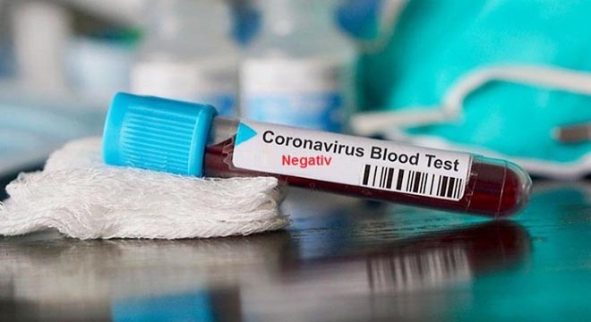 Gözlem altına alınan çiftte koronavirüse rastlanmadı