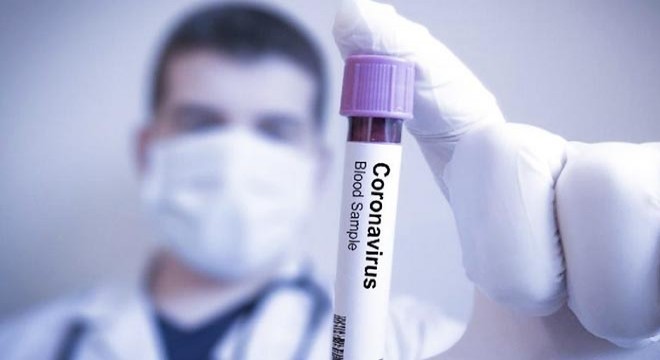 İngiltere’de koronavirüse karşı 5 farklı ilaç denemesi