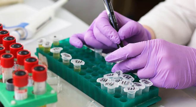 İngiltere’de yeni yüzde 100 doğruluk payı olan koronavirüs testi