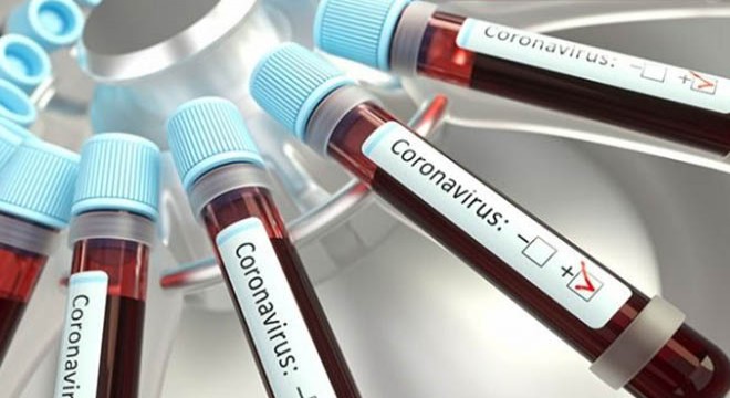 İran da koronavirüs bilançosu artıyor