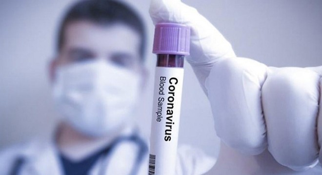 İran da koronavirüsten 97 kişi daha hayatını kaybetti