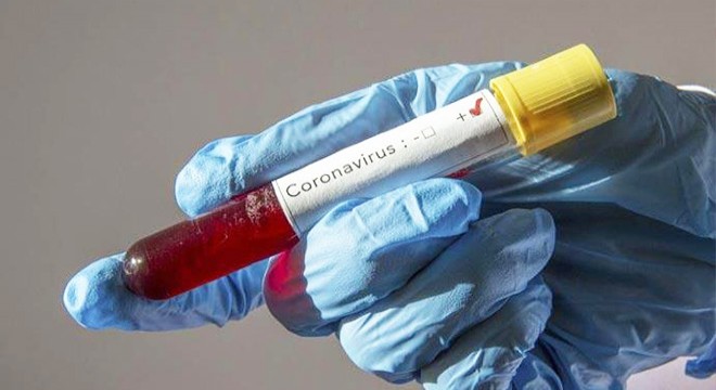 İran da koronavirüsten ölenlerin sayısı 1284’e çıktı