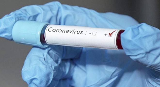 İşçinin koronavirüs testi pozitif çıktı, 2 fabrikada üretim durdu