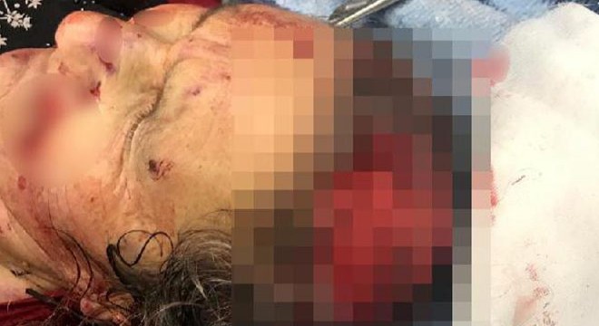 Kırşehir de köpeklerin saldırdığı kadın ağır yaralandı