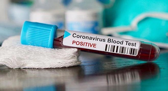 Koronavirüs alarmı ordulara sıçradı