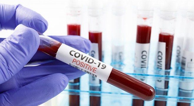 Koronavirüs hakkında 10 milyona yakın haber çıktı
