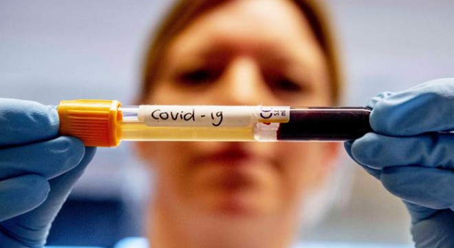 Kosova’da koronavirüs tespit edilenlerin sayısı 61’e çıktı