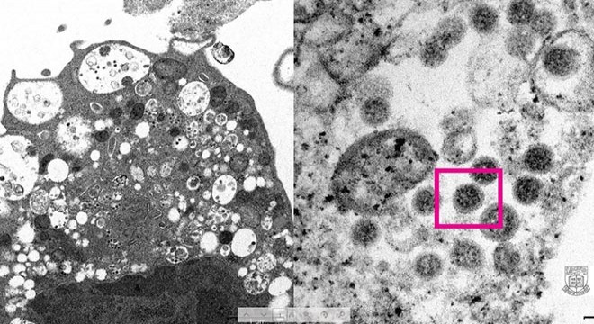 Omicron varyantının elektron mikroskobu görüntüsü yayınlandı