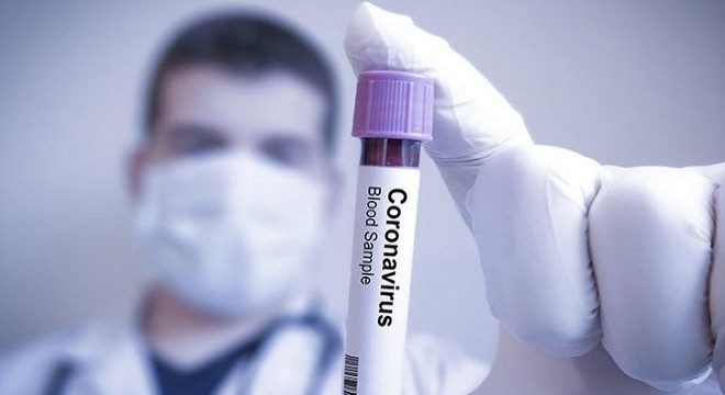 Rusya’da 4 bin 69 kişide daha koronavirüs tespit edildi