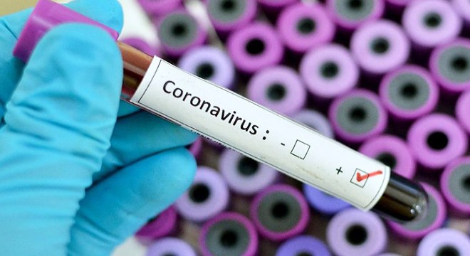 Rusya’da 9 bin 263 yeni koronavirüs vakası