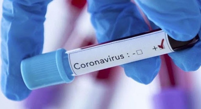Rusya’da 9 bin 859 yeni koronavirüs vakası