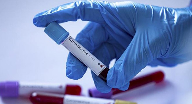 Rusya’da rekor artış: 9 bin 623 yeni koronavirüs vakası