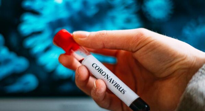 Rusya’da son 24 saatte 6 bin 411 yeni koronavirüs vakası