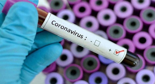 Rusya’da son 24 saatte 9 bin 974 yeni koronavirüs vakası