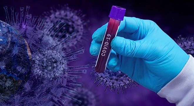 Rusya’da son 24 saatte koronavirüsten 475 can kaybı