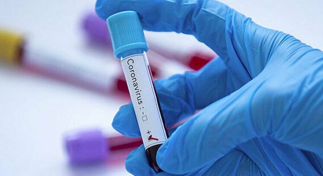 Rusya’daki koronavirüs hastalarının yarısı semptom göstermiyor