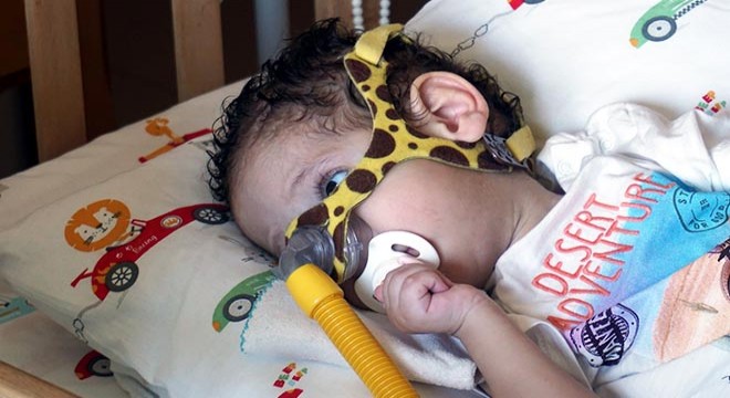 SMA hastası bebekler tedavi için yardım bekliyor