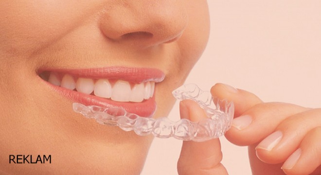 Şeffaf Plaklar ve Diş Telleri Arasındaki Farklar