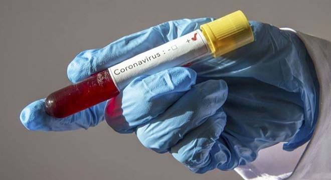 Silivri Cezaevi nde 44 tutuklu/hükümlüde koronavirüs tespit edildi