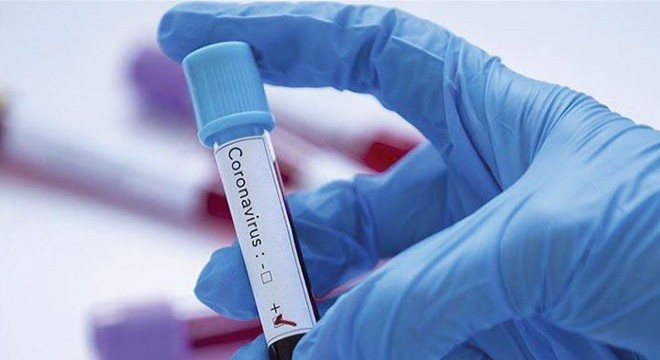 Suudi Arabistan’da koronavirüsten ilk ölüm