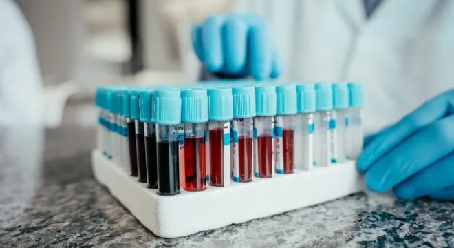 Tek bir kan testiyle 10 yıl sonrası görülebilecek