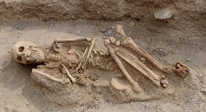 Urartular a ait iskeletlerde çürük diş çıkmadı