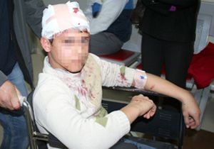 Polise atacakları bomba ellerinde patladı: 2 gösterici yaralandı