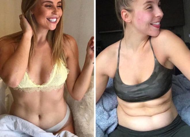Ünlü fitness bloggeri, Instagram pozlarının gerçek yüzünü böyle gösterdi - 6
