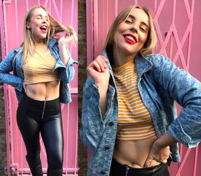 Ünlü fitness bloggeri, Instagram pozlarının gerçek yüzünü böyle gösterdi - 19