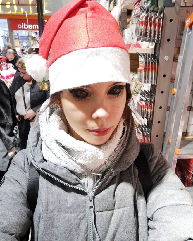 Gözlerine dövme yaptıran genç kız kör oldu! - 8