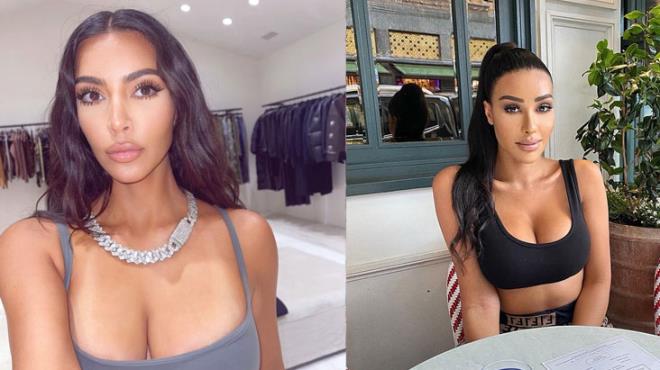 Kim Kardashian'a benzemek için 17 milyon lira harcadı! - 2