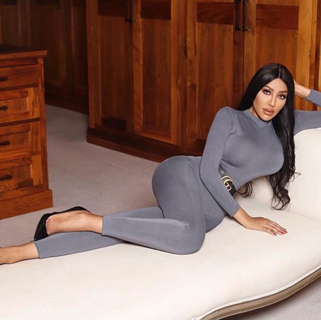 Kim Kardashian'a benzemek için 17 milyon lira harcadı! - 8