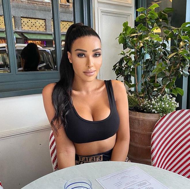 Kim Kardashian'a benzemek için 17 milyon lira harcadı! - 5