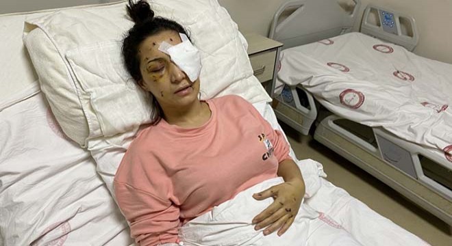 'Ağabey' demeyen yengesini 37 yerinden bıçaklayıp kör etti