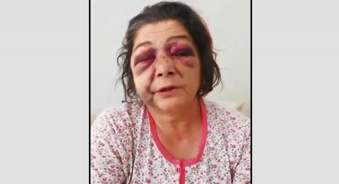 'Bakımsız park' tartışmasında oğlu ve gelini ile birlikte darbedildi