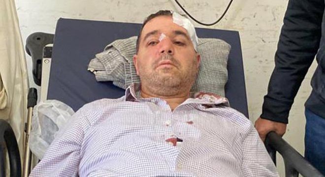 'Beni taciz ediyorsun' diyerek doktorun burnunu kırdı
