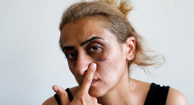 'Ensemde ölüm kokusu alıyorum, lütfen sesime ses olun'