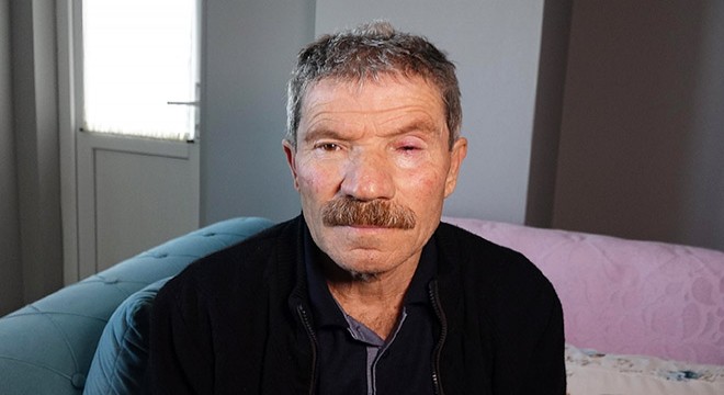 'Katarakt ameliyatı kör etti' iddiasına soruşturma