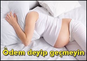 Ödem deyip geçmeyin