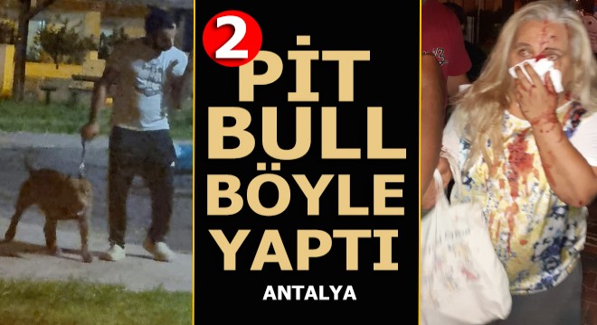  Abla bir şey yapmaz  dedi, pitbulları kadına saldırdı