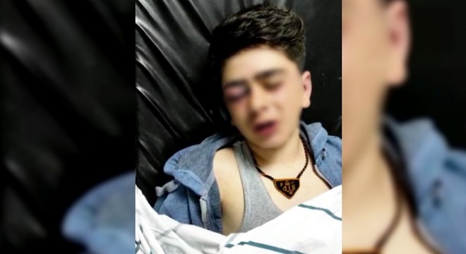 14 yaşındaki çocuğa işkence iddialarına soruşturma