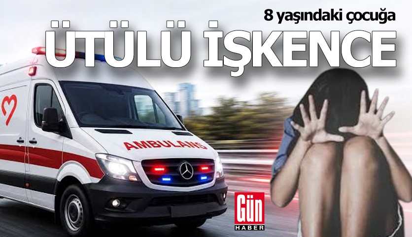 8 yaşındaki çocuğa üvey anneden ütülü işkence: 3 tutuklama