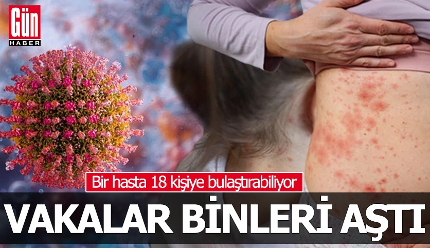 Vakalar hızla tırmanıyor, sayı binleri aştı!